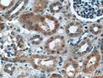 ASPH Antibody in Immunohistochemistry (Paraffin) (IHC (P))
