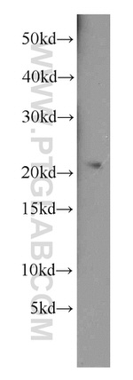 RPL9 Antibody in Western Blot (WB)