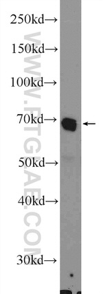 FADS Antibody in Western Blot (WB)