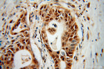 RPL17 Antibody in Immunohistochemistry (Paraffin) (IHC (P))