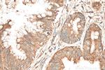 RPL17 Antibody in Immunohistochemistry (Paraffin) (IHC (P))