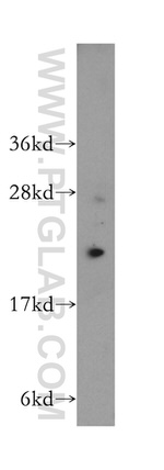 RPL17 Antibody in Western Blot (WB)