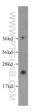 RPL17 Antibody in Western Blot (WB)