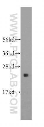 RPL17 Antibody in Western Blot (WB)