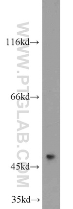 MARCKSL1 Antibody in Western Blot (WB)