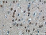 CDC26 Antibody in Immunohistochemistry (Paraffin) (IHC (P))