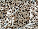 PRDM5 Antibody in Immunohistochemistry (Paraffin) (IHC (P))