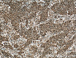 PRDM5 Antibody in Immunohistochemistry (Paraffin) (IHC (P))