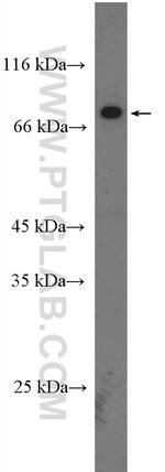 PRDM5 Antibody in Western Blot (WB)