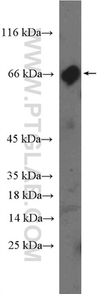 PRDM5 Antibody in Western Blot (WB)
