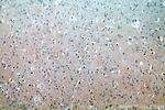 APC4 Antibody in Immunohistochemistry (Paraffin) (IHC (P))