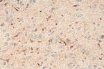 APC4 Antibody in Immunohistochemistry (Paraffin) (IHC (P))