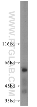 APC4 Antibody in Western Blot (WB)