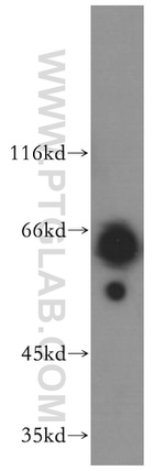 APC4 Antibody in Western Blot (WB)