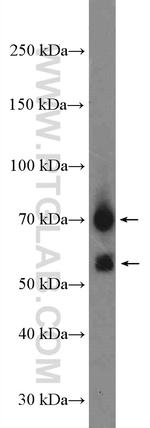 CHST15 Antibody in Western Blot (WB)
