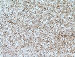 GFPT1 Antibody in Immunohistochemistry (Paraffin) (IHC (P))