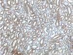 beta-ENaC Antibody in Immunohistochemistry (Paraffin) (IHC (P))