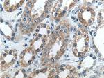 beta-ENaC Antibody in Immunohistochemistry (Paraffin) (IHC (P))