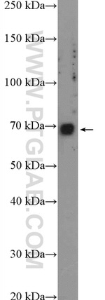 KCNK5 Antibody in Western Blot (WB)