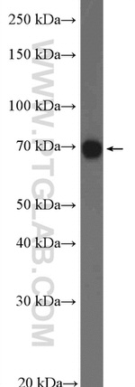 KCNK5 Antibody in Western Blot (WB)