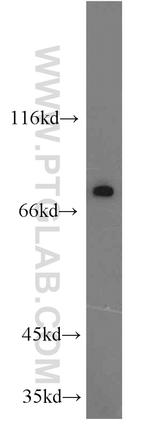 KCNK5 Antibody in Western Blot (WB)
