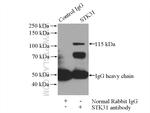 STK31 Antibody in Immunoprecipitation (IP)