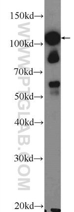 STK31 Antibody in Western Blot (WB)