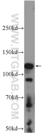 STK31 Antibody in Western Blot (WB)