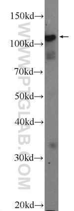 STK31 Antibody in Western Blot (WB)