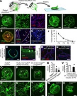 CD140a (PDGFRA) Antibody in Immunohistochemistry, Immunocytochemistry (IHC, ICC/IF)