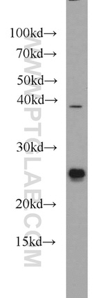 TMED4 Antibody in Western Blot (WB)