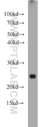 TMED4 Antibody in Western Blot (WB)