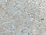 Synaptoporin Antibody in Immunohistochemistry (Paraffin) (IHC (P))