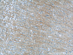 Synaptoporin Antibody in Immunohistochemistry (Paraffin) (IHC (P))