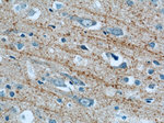 Synaptoporin Antibody in Immunohistochemistry (Paraffin) (IHC (P))