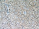 Synaptoporin Antibody in Immunohistochemistry (Paraffin) (IHC (P))
