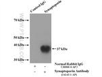 Synaptoporin Antibody in Immunoprecipitation (IP)