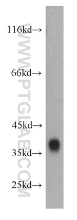 Synaptoporin Antibody in Western Blot (WB)