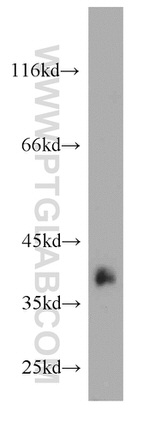 Synaptoporin Antibody in Western Blot (WB)
