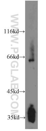 Synaptoporin Antibody in Western Blot (WB)