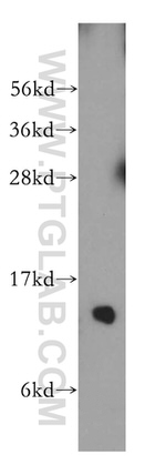 FXN Antibody in Western Blot (WB)