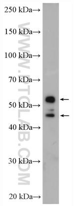 SHMT1 Antibody in Western Blot (WB)