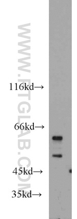 SHMT1 Antibody in Western Blot (WB)
