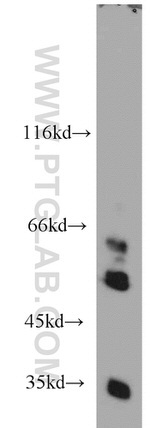 SHMT1 Antibody in Western Blot (WB)