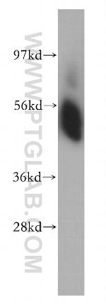 SHMT1 Antibody in Western Blot (WB)