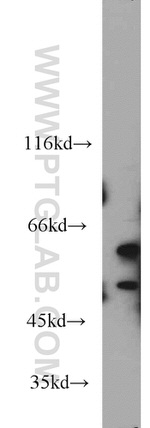 SHMT1 Antibody in Western Blot (WB)