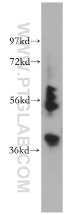 SHMT1 Antibody in Western Blot (WB)