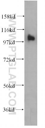 RASA3 Antibody in Western Blot (WB)