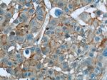 RP2 Antibody in Immunohistochemistry (Paraffin) (IHC (P))