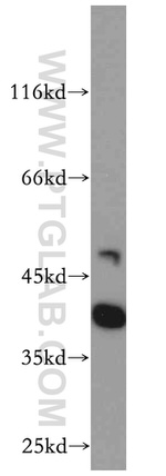 RP2 Antibody in Western Blot (WB)
